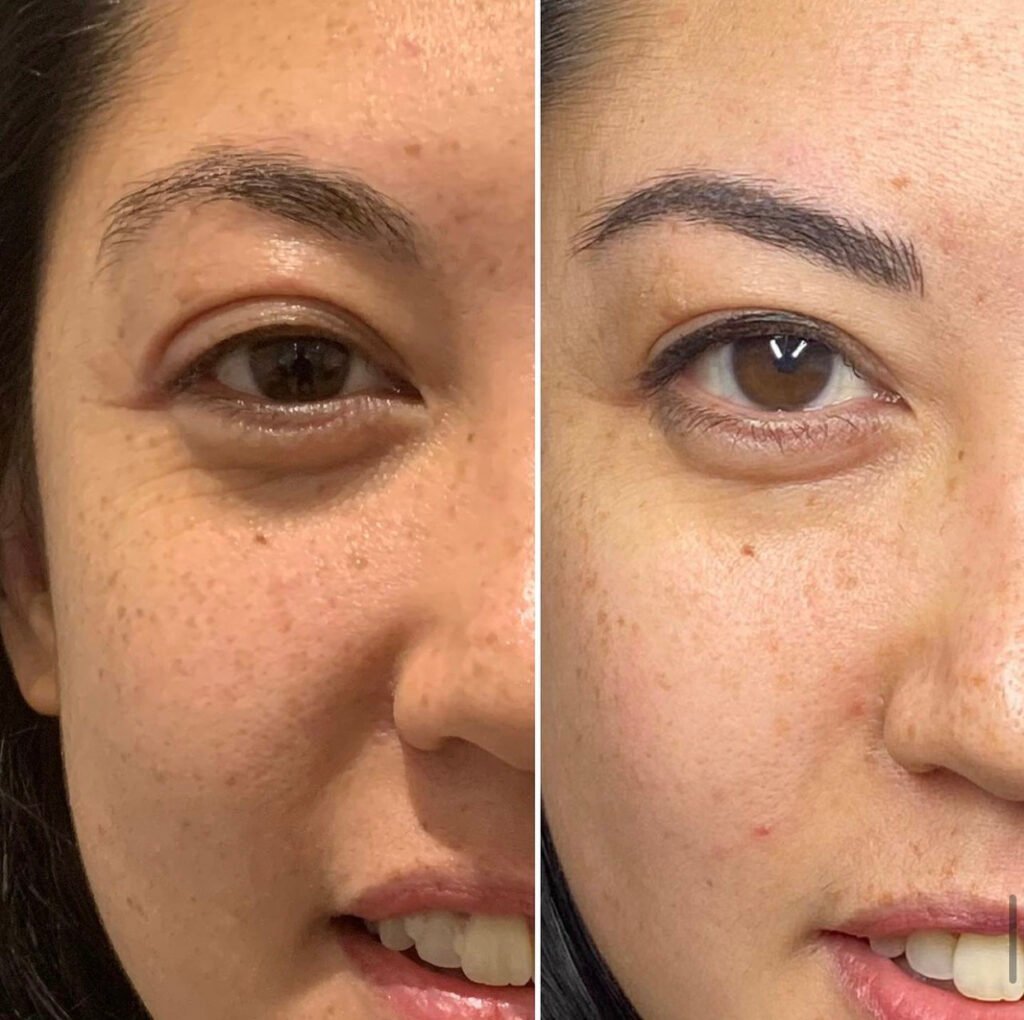 permanent makeup prices Bristol nano brows before after