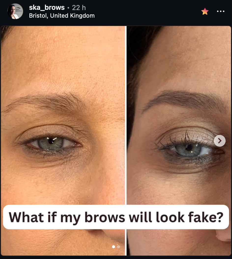 Nano brows healing process