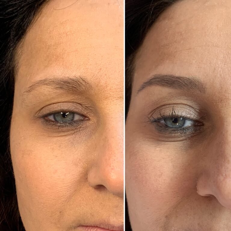 Nano brows healing process