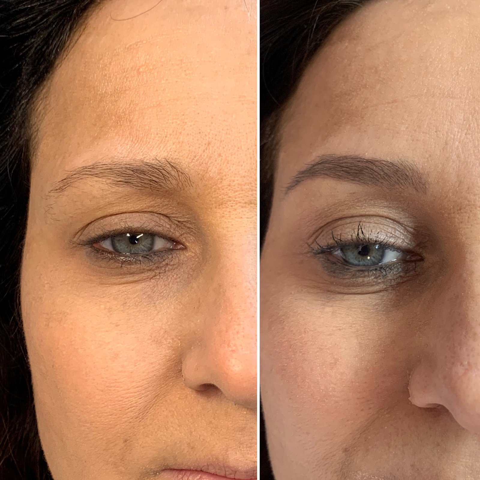 Nano brows healing process