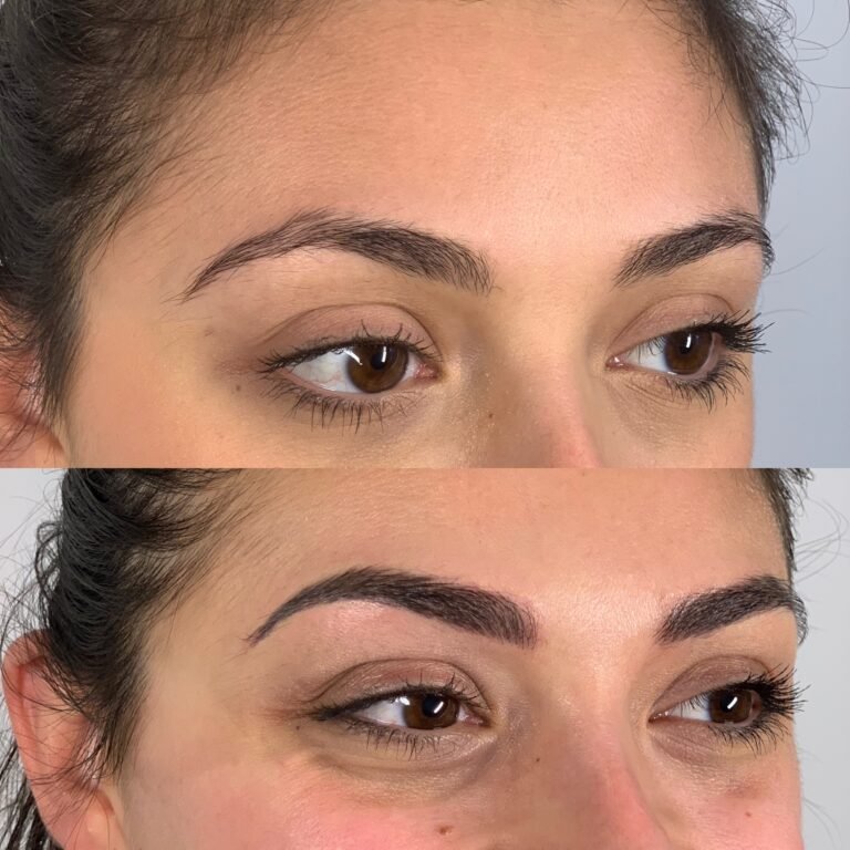 Best brow treatments bristol